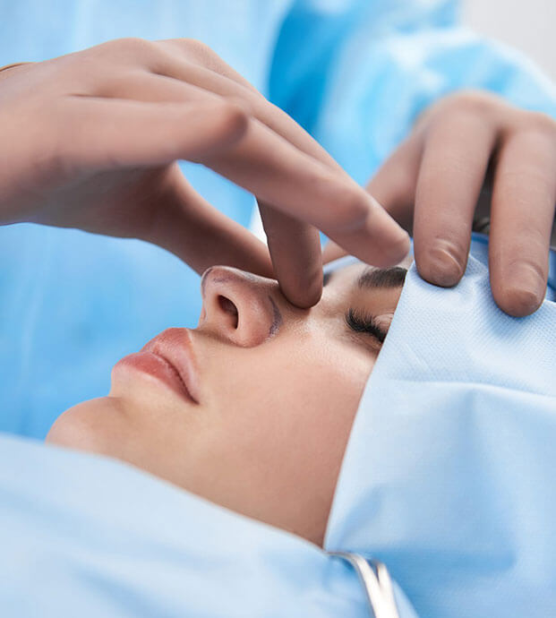 rhinoplasty-i1